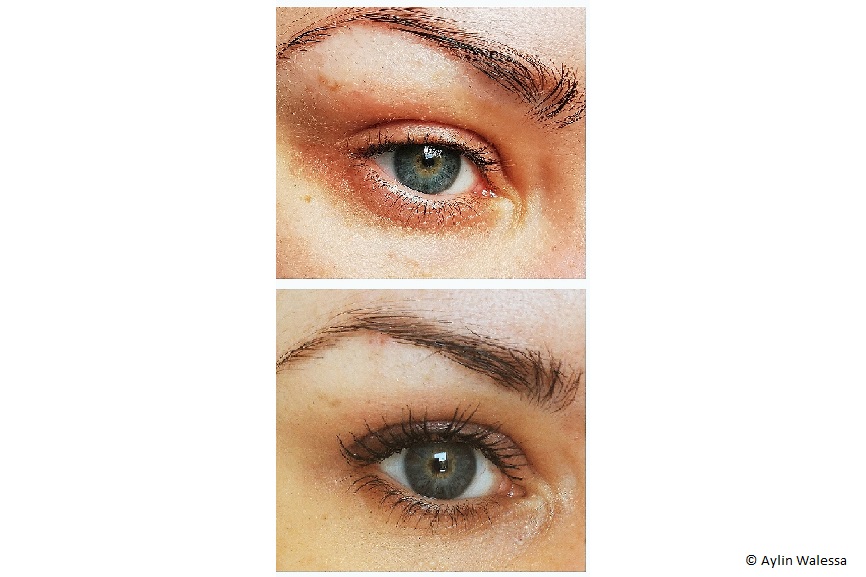 Zwei Close-Ups von Aylins Auge zu verschiedenen Zeiten. 