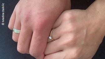 Ein Foto von Medines Hand, die von einer anderen Hand gehalten wird. Beide tragen einen Ehering. 
