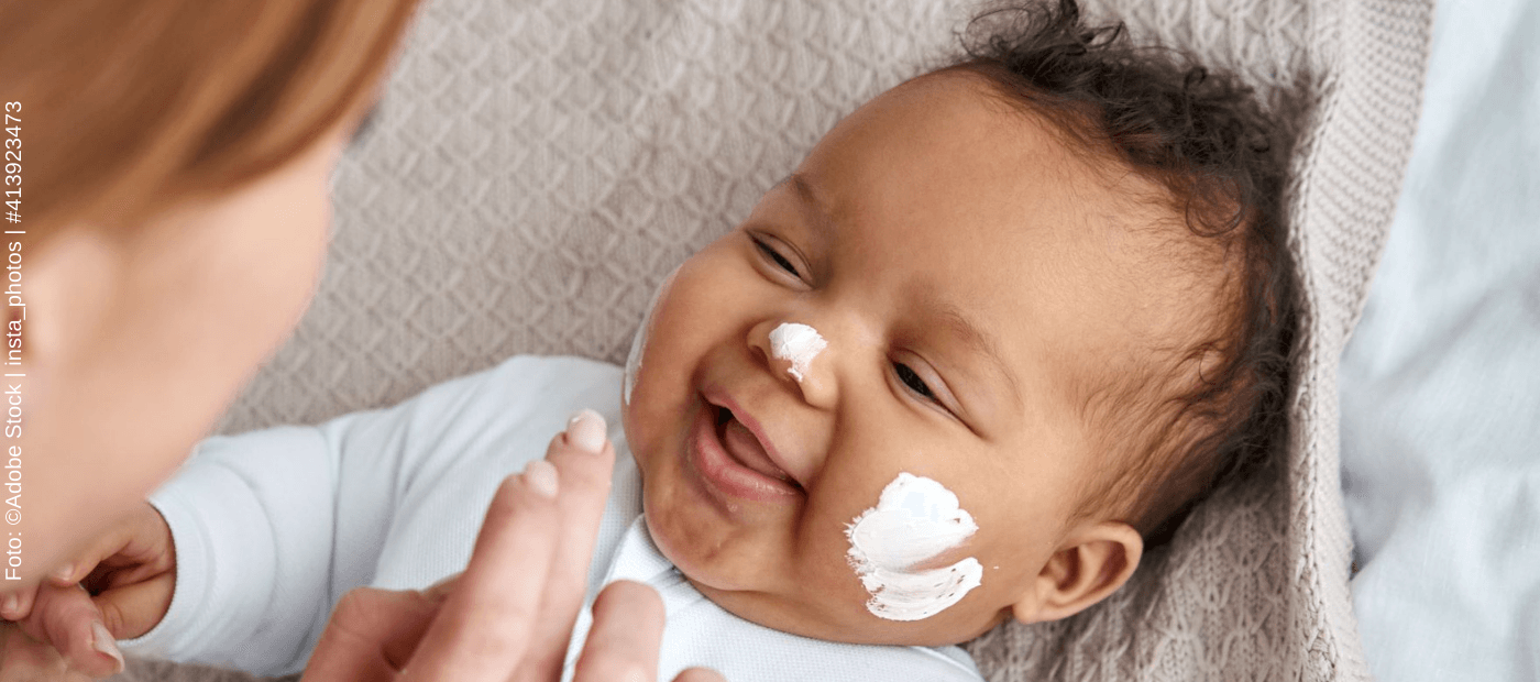 Babys mit Neurodermitis – Was die Diagnose ändert