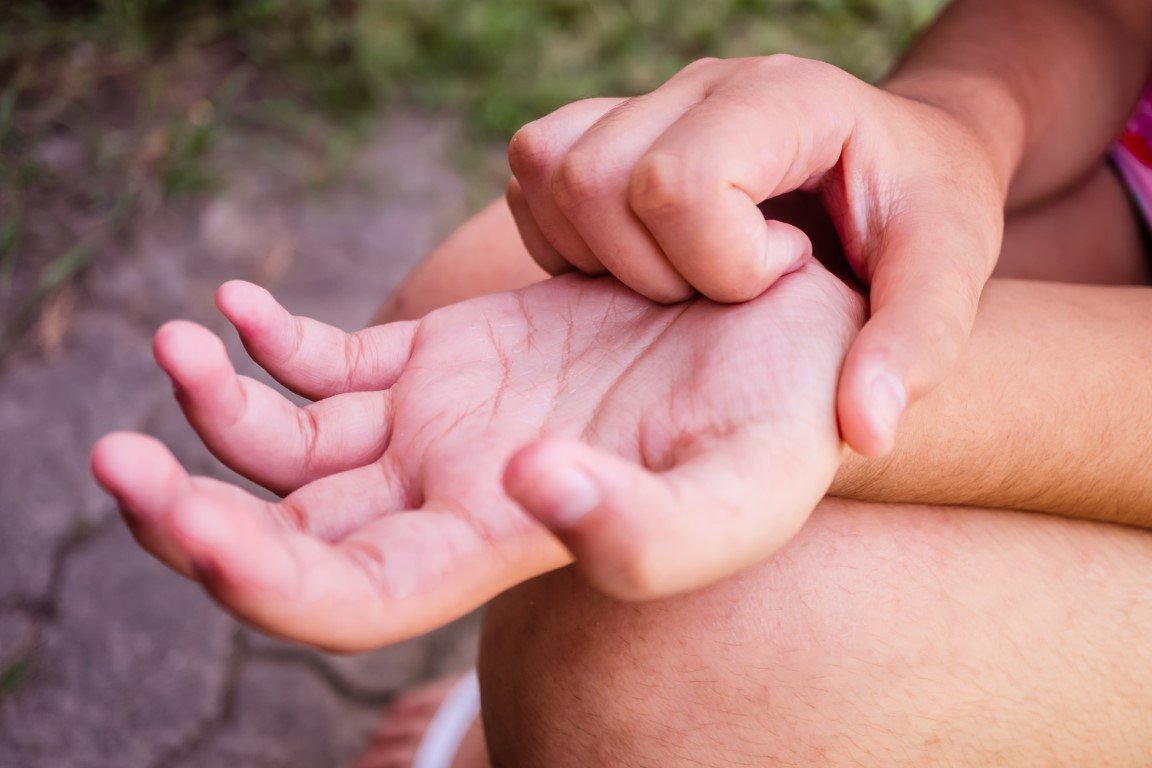 Person, die sich an der Hand kratzt