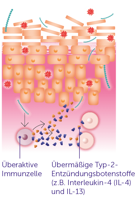 Darstellung der Hautbarriere im Falle von intakter Haut und bei Neurodermitis