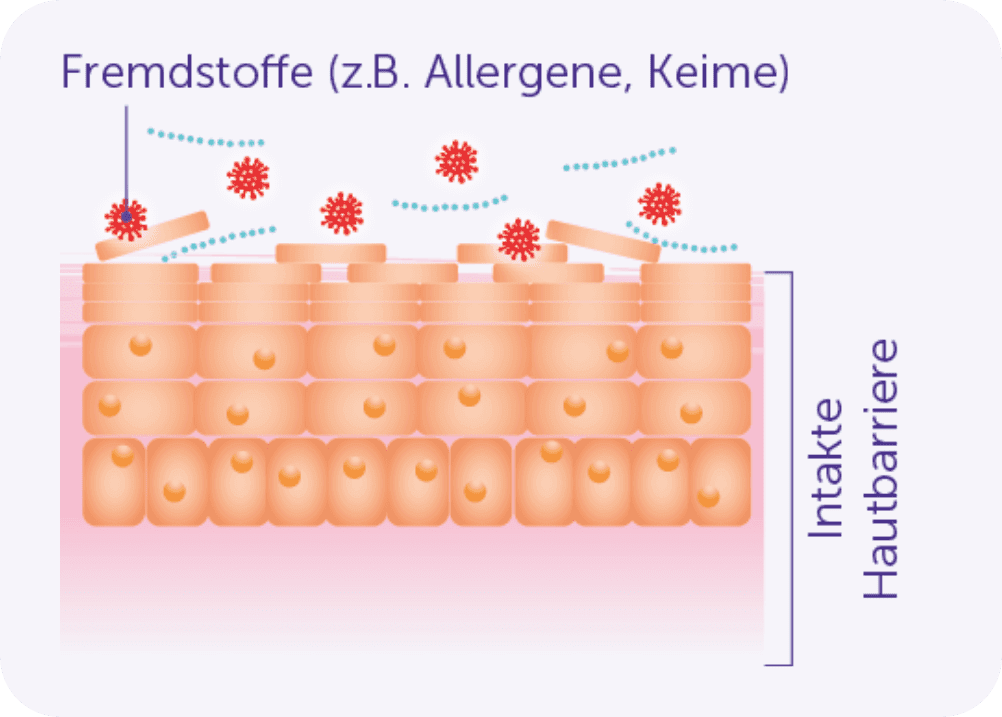 Darstellung der Hautbarriere im Falle von intakter Haut und bei Neurodermitis