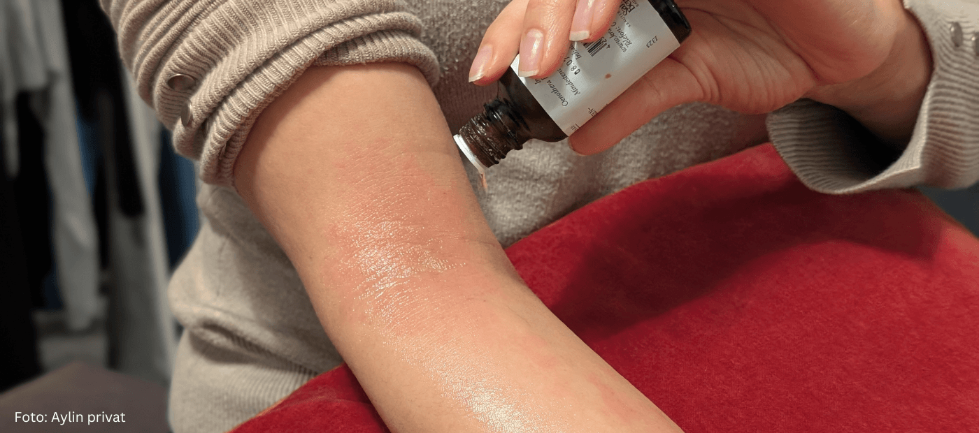 Eine Person nutzt zur lindernden Anwendung bei Neurodermitis Öl